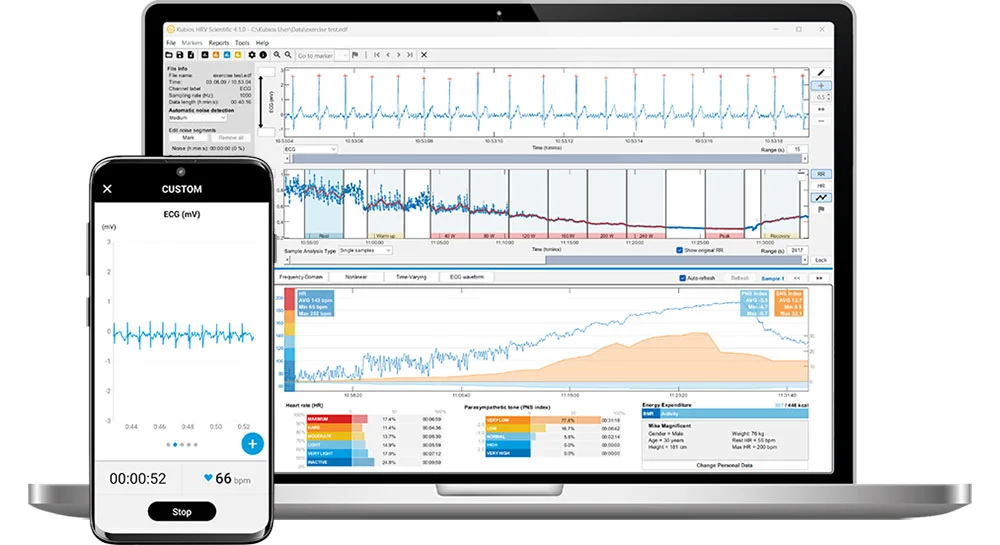 HRV analysis software - (Kubios HRV Premium version 3.4.2; Kubios Oy, Kuopio, Finland)